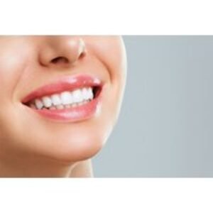 Teeth Whitening Consultation with Customised Whitening Plan - Euro Dental Clinic