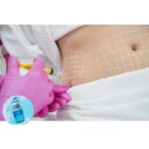 1 Session of Aqualyx Fat-Dissolving Injections or Aqualyx 360 - Raquel Menezes Aesthetics