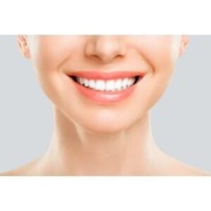Professional Teeth Whitening Session at Opium Aesthetics Skin and Hair Clinic
