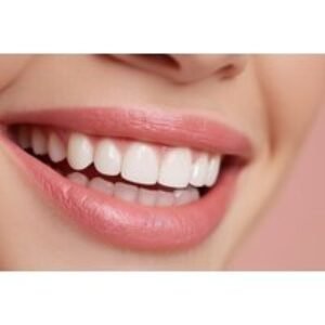 Award Winning Composite Bonding for 2