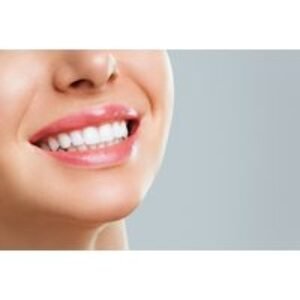 Dental Hygiene Scale & Polish with Check up & Xray -Airflow Upgrade - Wembley Orthodontic & Aesthetics | Wowcher