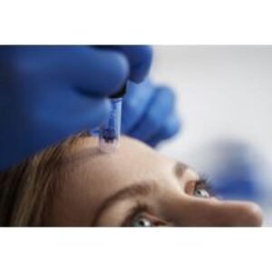 Microneedling Facial or Skin Peel Treatment - Aesthetics Works
