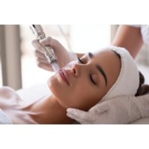 45-Minute Microneedling Facial for Collagen Renewal - Stockport | Wowcher
