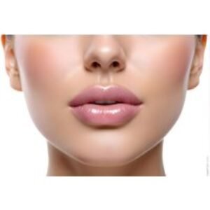 1ml Dermal Lip Filler Treatment at Vital Aesthetics - Sutton Coldfield | Wowcher