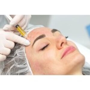 PRP Vampire Facial & LED Therapy - 1 or 3 Smoothing Treatments at KLC Well-Being For All