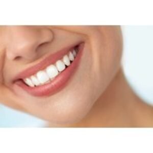 Professional Teeth Whitening Session at Pebble Brook Clinic - On-Site Treatment in Exeter | Wowcher