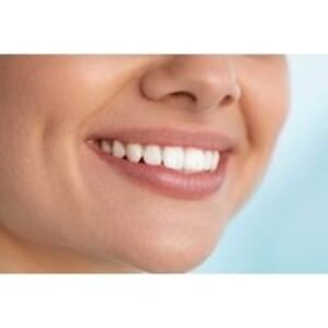 Laser Diamond Teeth Whitening - One-Hour NaturaWhite Treatment at Peridot Aesthetics
