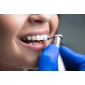 Professional Dental Clean