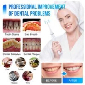 Ultimate Electric Sonic Teeth Cleaning Kit - Professional Oral Care at Home | Wowcher