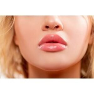 Filler on Choice of Area (1.1ml or 2.2ml) at Rejuvenate Aesthetics