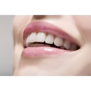1-Hour Zoom Whitening Dental Treatment with Consultation at A Silva Dental