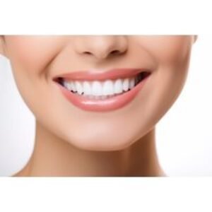 Laser Teeth Whitening Treatment with Megawhite Technology at Best Laser Room
