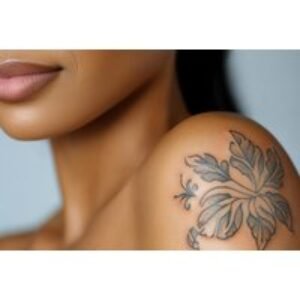 3 Sessions Tattoo Removal - Small