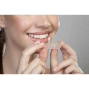 Invisible Aligners - Top