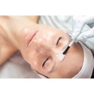 40-Minute Luxury Chemical Peel for One at Glam Fot Aesthetics