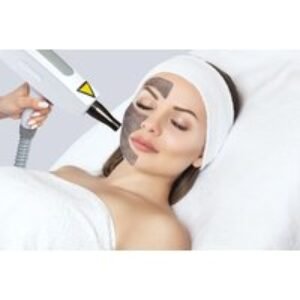 Carbon Laser Peel with Cooling Mask - 45-Minute 4-Step Facial at Laser Treat Esthetica