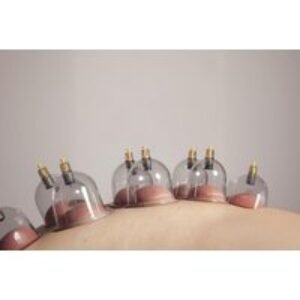 60-Minute Cupping Treatment - Choice of Fire or Dry - 24 Cups - Leicester | Wowcher