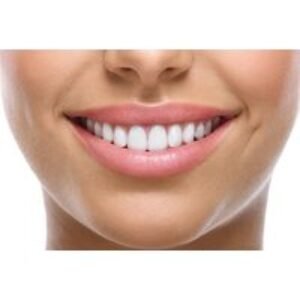 Zoom Laser Teeth Whitening - Up to 60 Min Consultation & Session - Chelsea Aesthetics